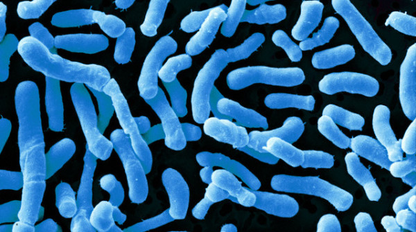 1461927523 bacteria-600x335